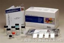 人抗雙鏈DNA抗體/天然DNA抗體試劑盒