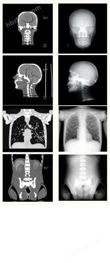 KYOTO KAGAKU PBU-60全身CT模体